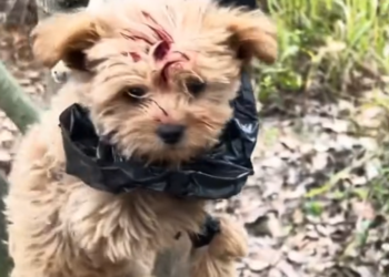 T3001044 The body weakened faster than hope