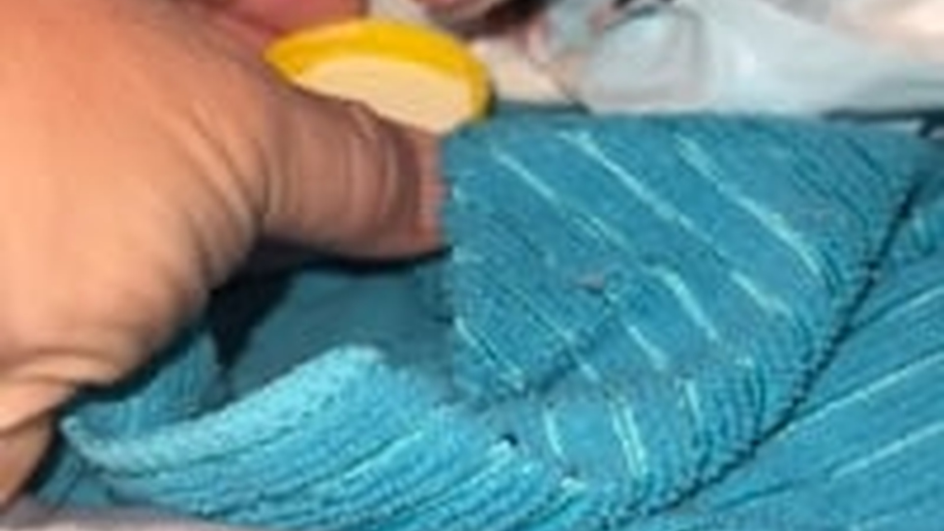 N2205179_My dog found a baby opossum in my backyard I decided to adopt it_part2